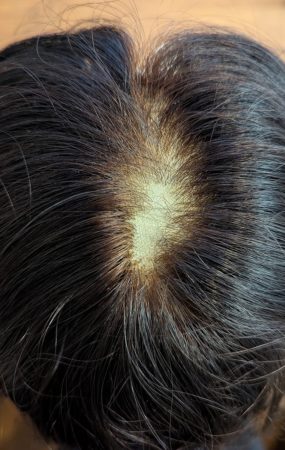 女性用ウィッグの増毛修理はできる？費用目安・流れ・事例を紹介