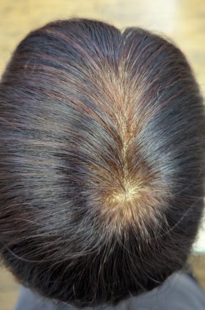 女性用ウィッグ増毛修理